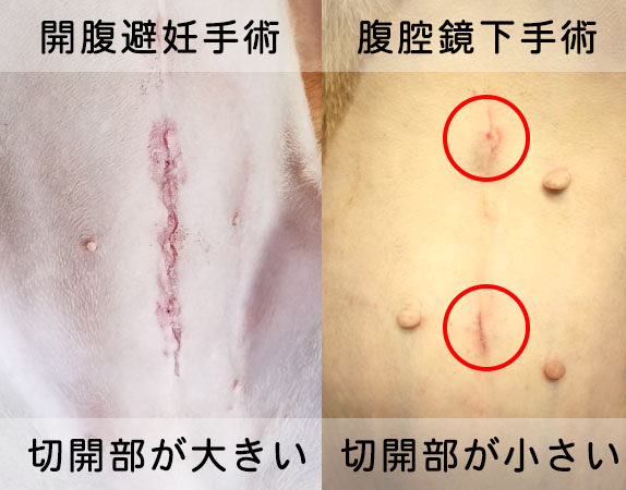 広島市 腹腔鏡下手術なら傷口が小さく治りが早い